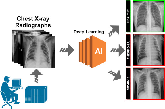Lung X-ray classification AI results