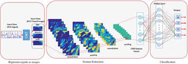 ECG signal AI model visualization